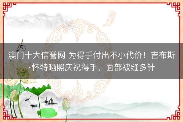 澳门十大信誉网 为得手付出不小代价！吉布斯·怀特晒照庆祝得手，面部被缝多针