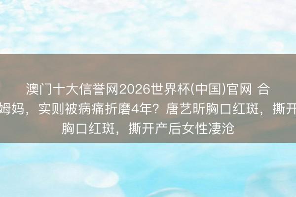 澳门十大信誉网2026世界杯(中国)官网 合计退圈当全职姆妈,实则被病痛折磨4年?唐艺昕胸口红斑,撕开产后女性凄沧